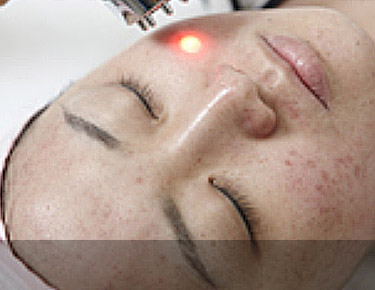 ���� �׶��� (���� ��� ����) ����