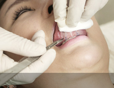 �������� ������� (���� ���� ����) ����