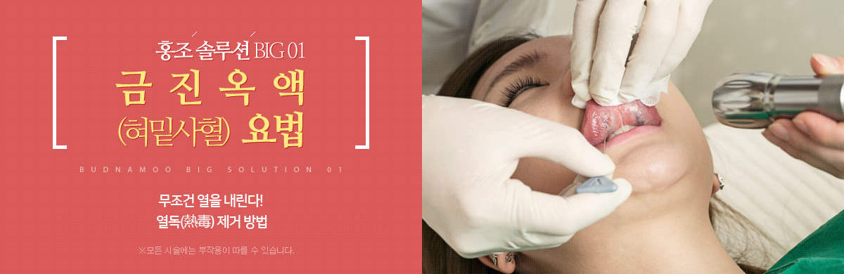 ±ÝÁø¿Á¾× ¿ä¹ý