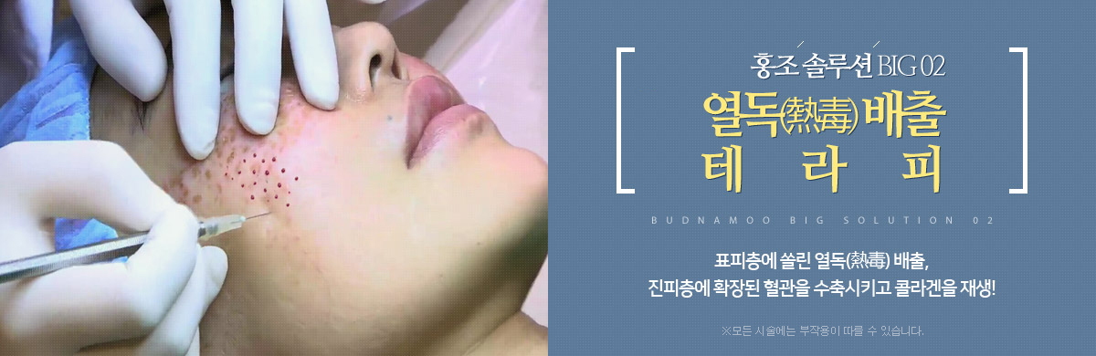 ¿µ¶¹èÃâ Å×¶óÇÇ